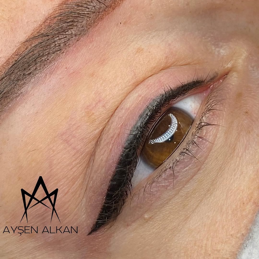Ayşen Alkan